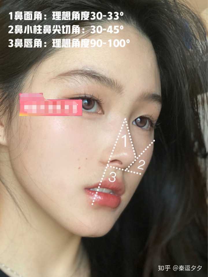 隆鼻失败率高吗 知乎 隆鼻失败率高吗 知乎