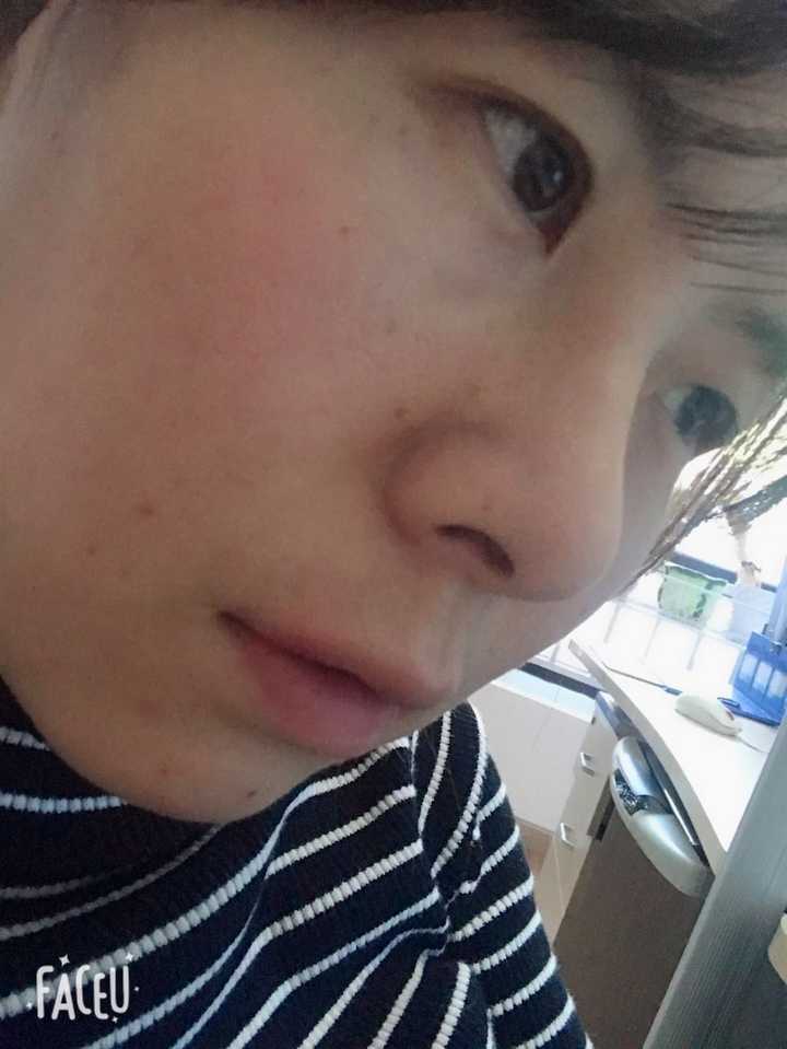 有没有因为鼻子不好看而毁了整张脸的例子?