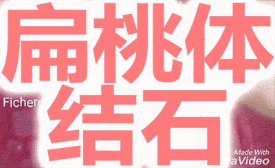 扁桃体结石了解一下?