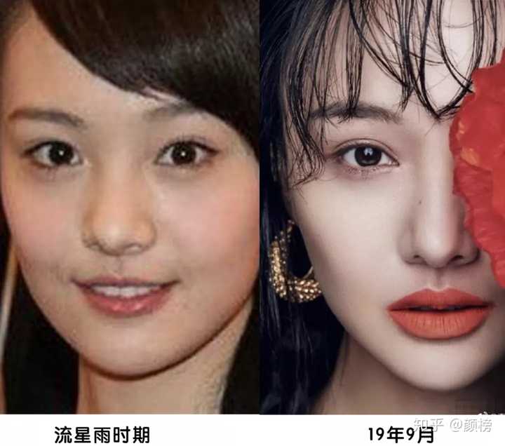 郑爽整容整了哪里?