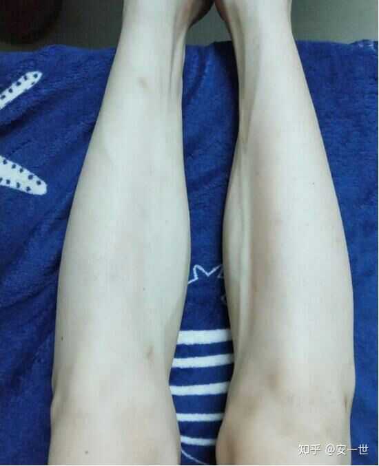 为什么现在很多男生都没腿毛了 知乎