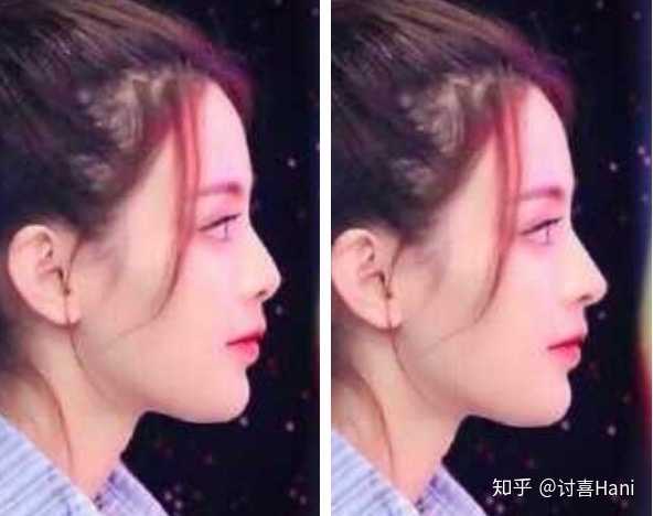 塌鼻梁女生一定不好看吗 知乎 塌鼻梁女生一定不好看吗 知乎