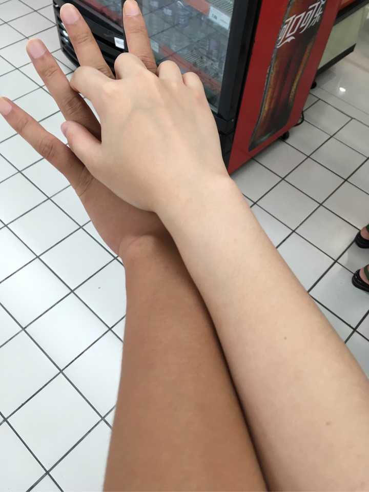 军训严重晒黑后如何快速变白?