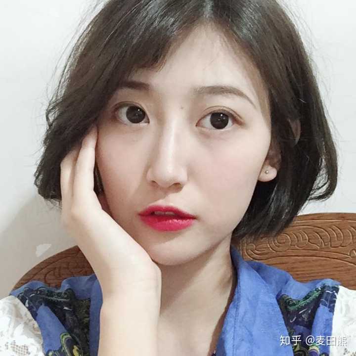 自己越看越喜欢,形态真的很好,很满意,虽然说埋线可能只会保持3-5年.