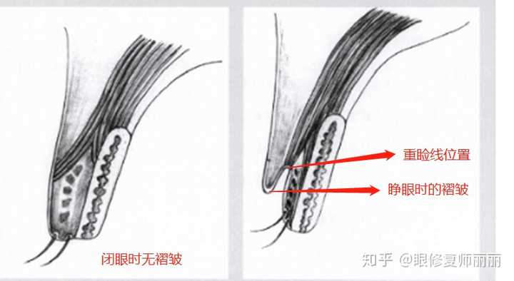 内双都会消失是什么原理? - 知乎