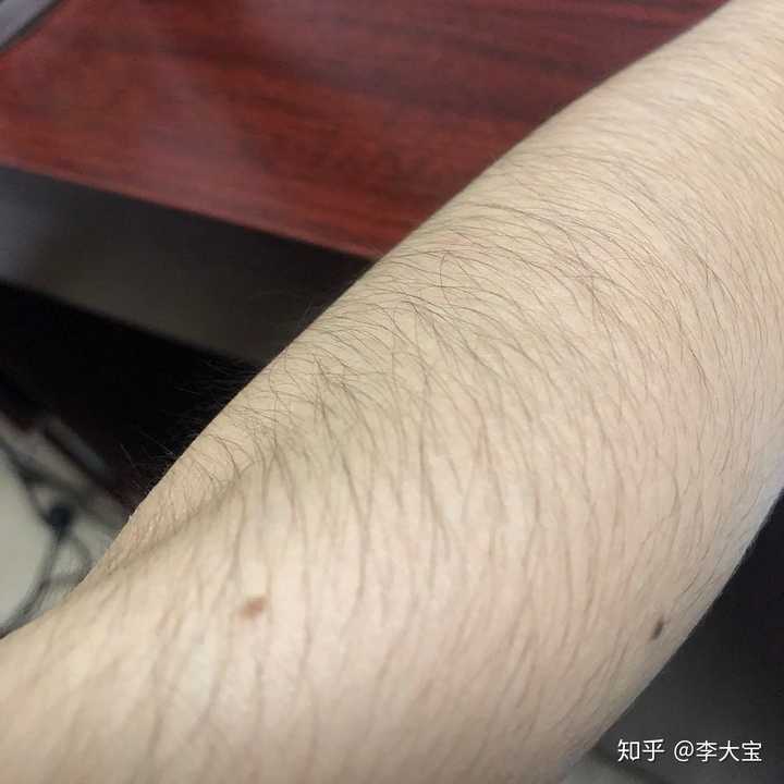 女生体毛旺盛是什么样的体验？ - 知乎