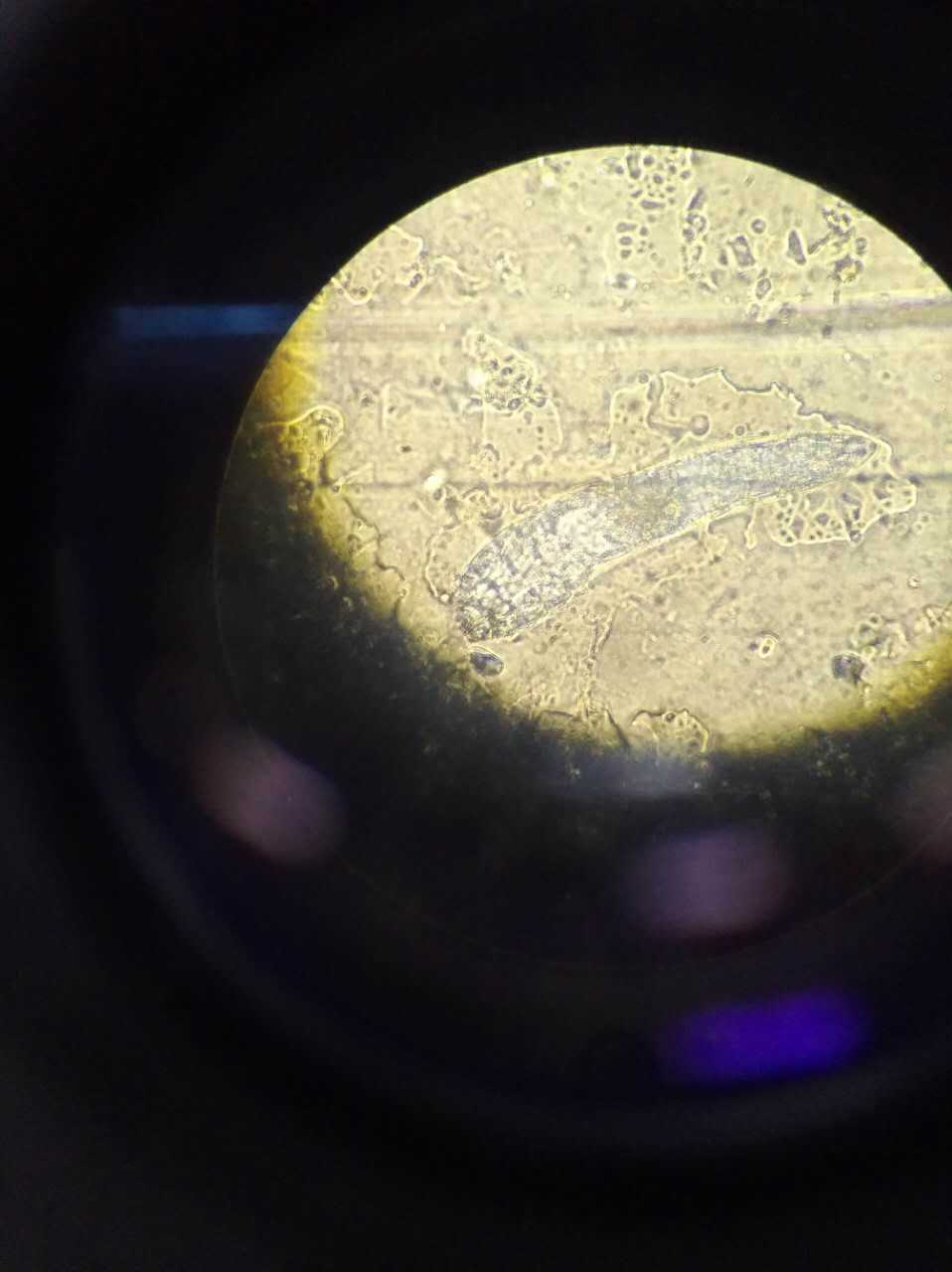 不是,螨虫用一般显微镜就可以看到,用胶布在脸上粘一夜,第二天观察