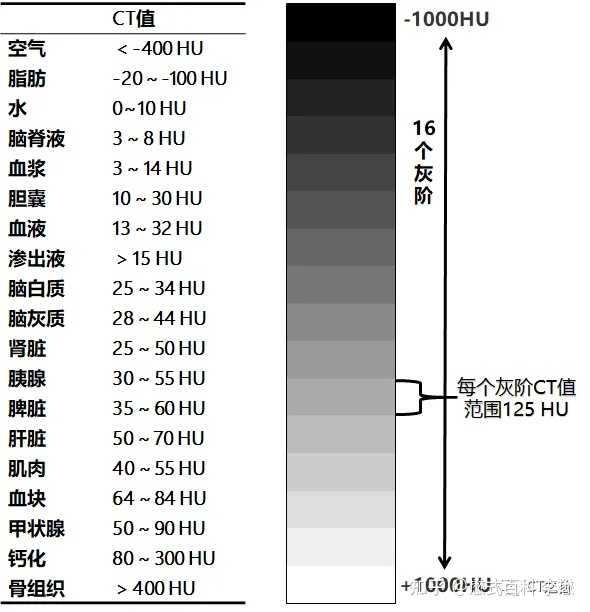 ct骨窗和软组织窗区别是啥? - 知乎