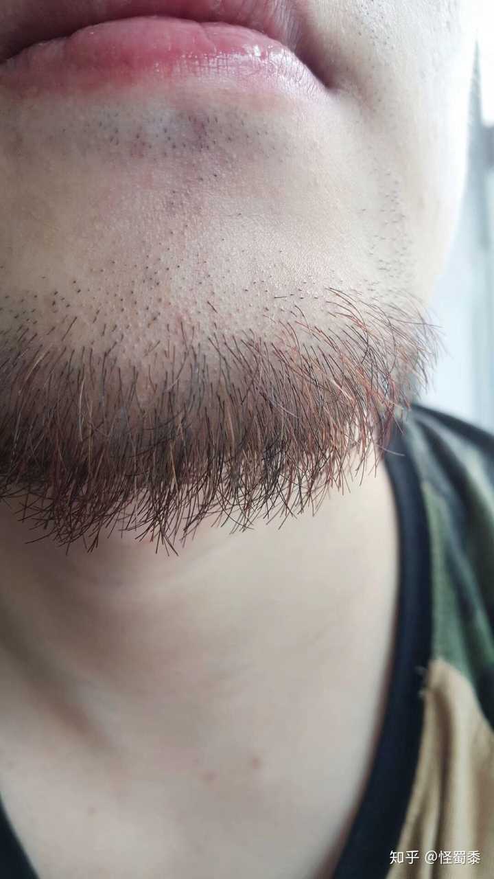 为什么从某个角度观察胡子会发现金色的胡子 然而换个角度同一根胡子又变成了黑色 怪蜀黍的回答 知乎 为什么从某个角度观察胡子会发现金色的胡子 然而换个角度同一根胡子又变成了黑色 怪蜀黍的回答 知乎