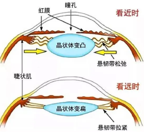 整天对着电脑眼睛酸涩 有哪些缓解视疲劳的方法 知乎 整天对着电脑眼睛酸涩 有哪些缓解视疲劳的方法 知乎