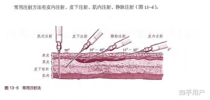 皮下注射、皮内注射和肌肉注射的区别? - 知乎