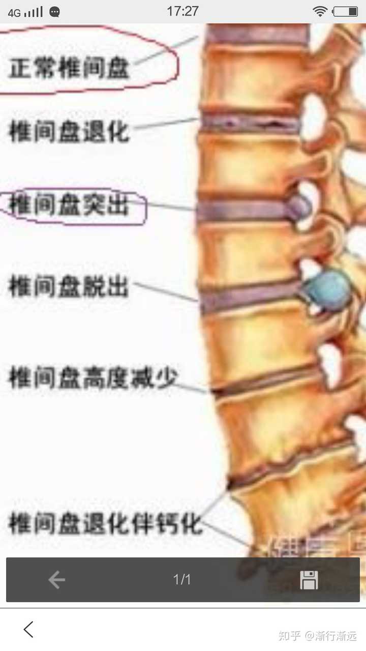 APT療法環椎骨盤調整法 | www.ddechuquisaca.gob.bo