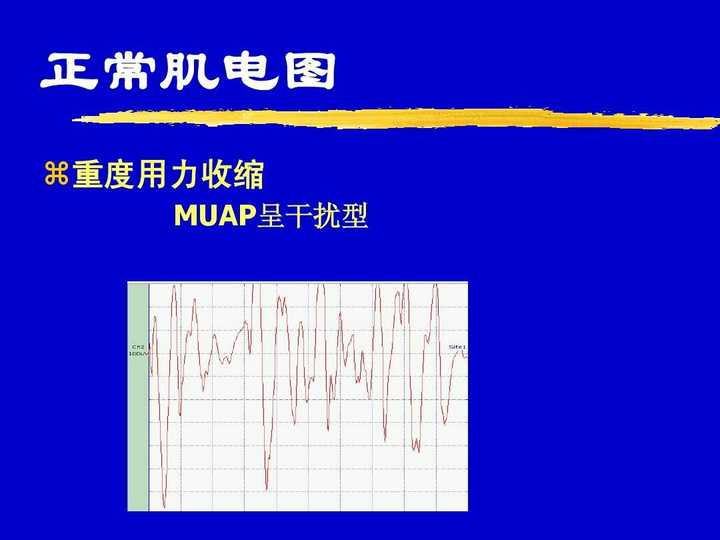 (虽然严格来说肌电图不是直接代表用力情况,但已经足以说明肌肉用力时