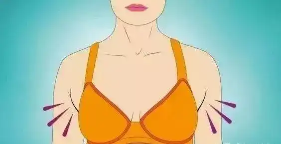 副乳大成这样正常吗？