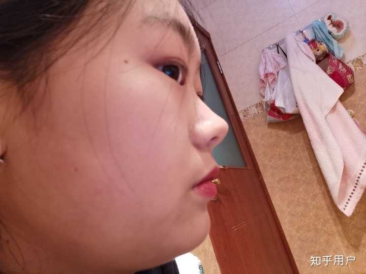 正脸正常,侧脸丑到爆是什么体验?