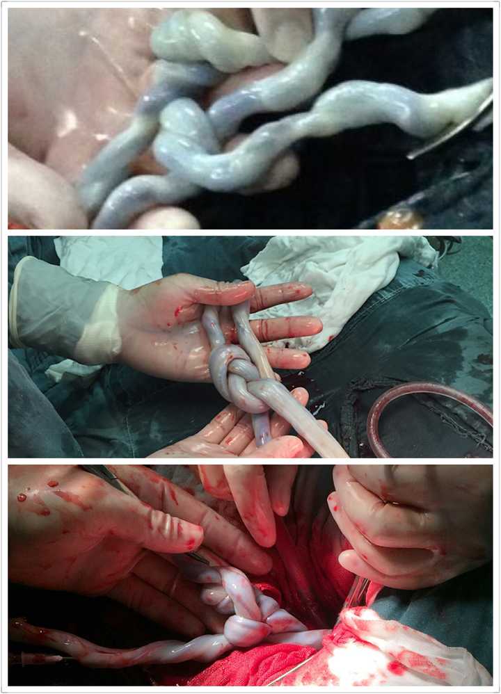 手机里你最不舍得删掉的一张照片是什么