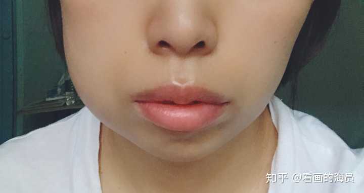 拔完智齿脸为什么会肿 知乎