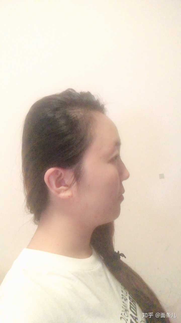 有一个超级扁平的侧脸是一种什么样的体验? - 知乎