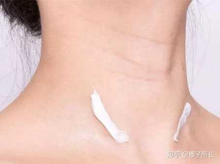 如何去颈纹 知乎