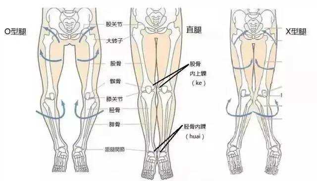 如何让腿变直？