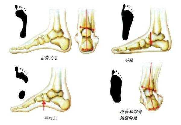 在我们成长过程中 有哪些容易忽略的医学常识或习惯 会造成 几乎 不可逆转的伤害 知乎