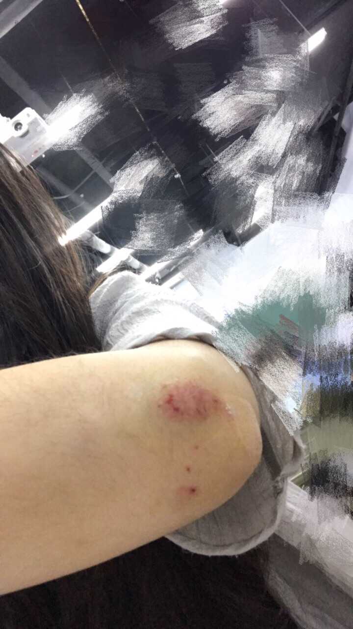 玩滑板摔倒是一种怎样的体验?