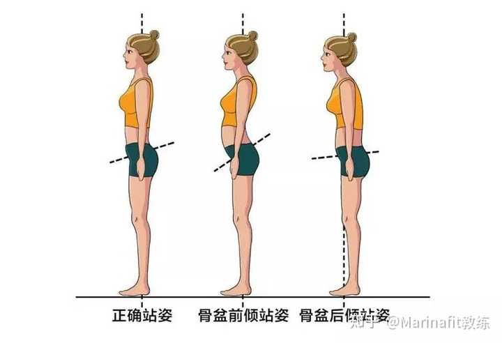 能教教我正确的站姿吗? - 知乎