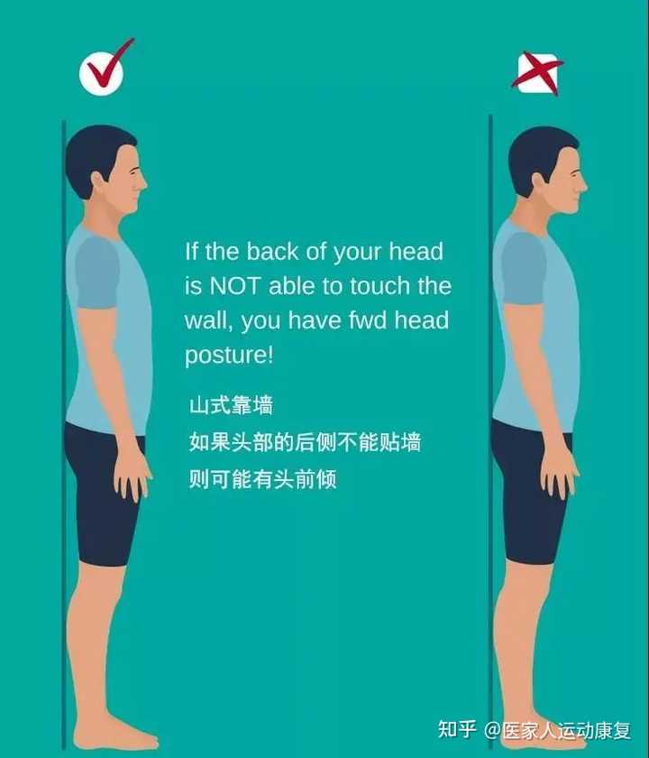 头前倾是如何形成的，该如何纠正呢？ - 知乎
