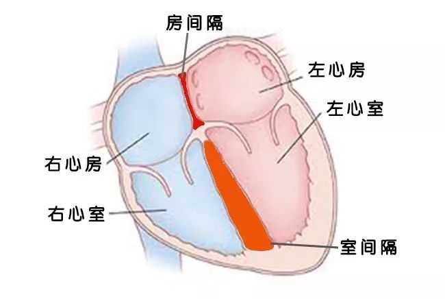 先心病房间隔缺损多大必须手术 知乎