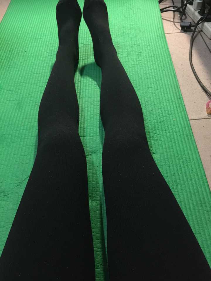 【有图啦】这样的腿型怎么矫正?女孩子,膝盖内突很厉害.