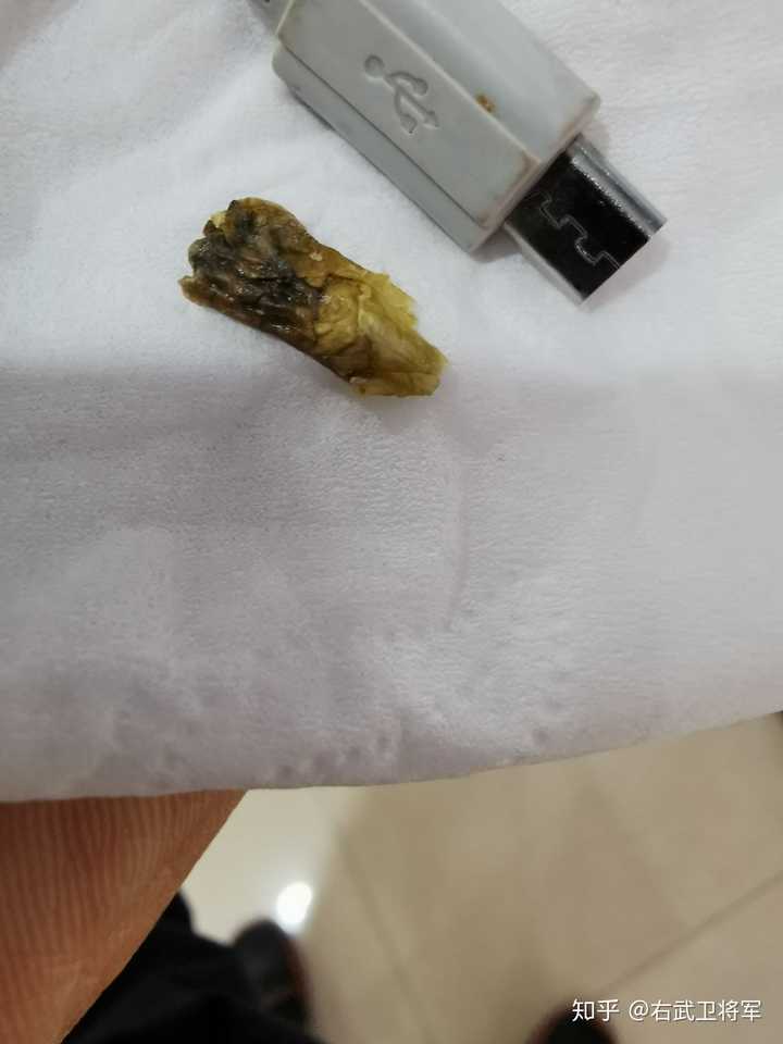 经常掏耳屎的人耳朵里还会有那种超大的耳屎(就像一些视频里拍的那样)