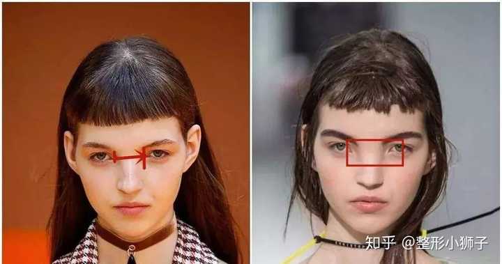为什么有些人侧面看有鼻梁 正面看没鼻梁 知乎 为什么有些人侧面看有鼻梁 正面看没鼻梁 知乎
