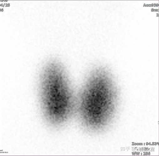 SPECT和PET和CT有什么区别，相比其他两者，SPECT有什么优势？ - 知乎
