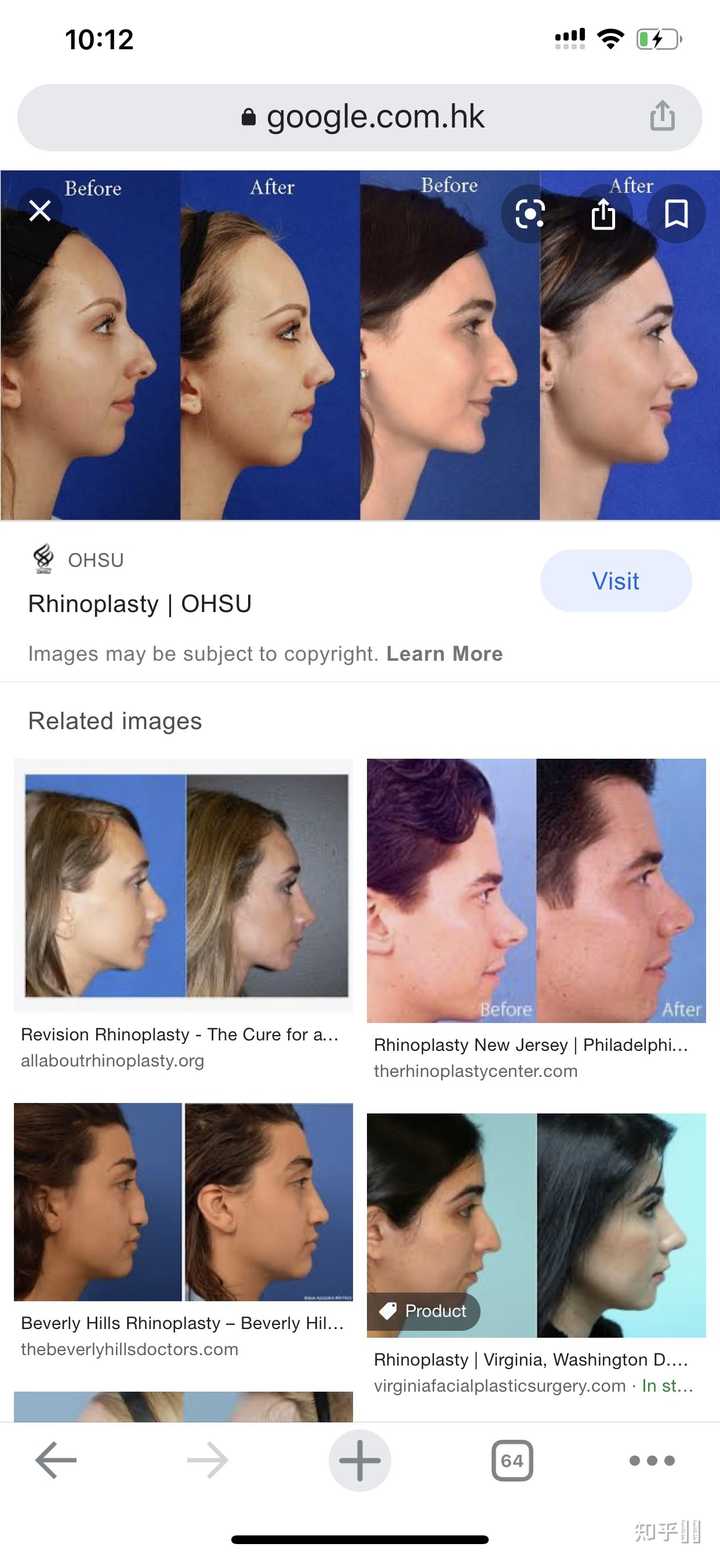 欧美白人或者中东白人整形的话一般是整哪里 知乎