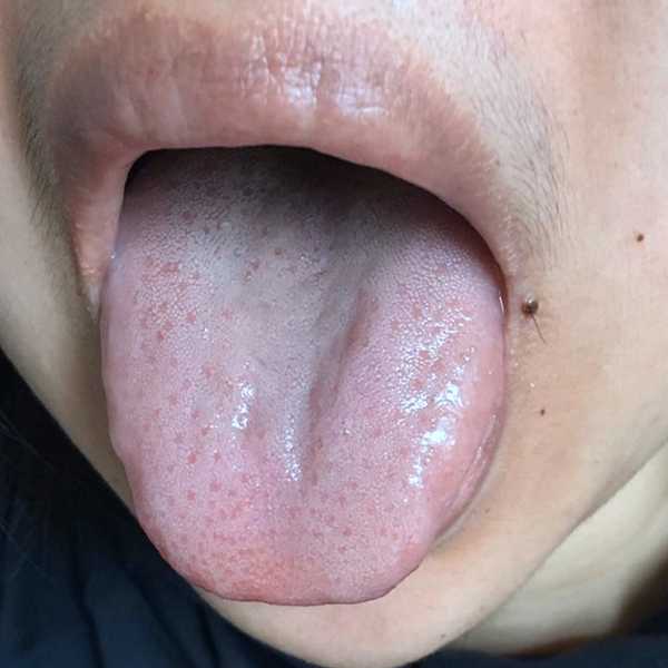艾草肚脐贴真的可以祛湿减肥吗?附案例-守护佛网