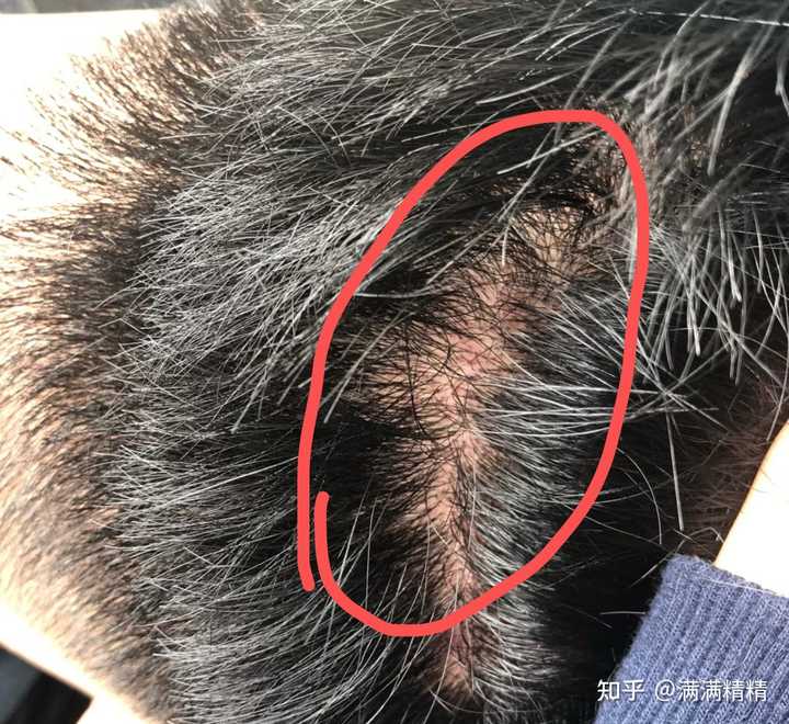 有哪些好用的男士洗发水值得推荐 知乎