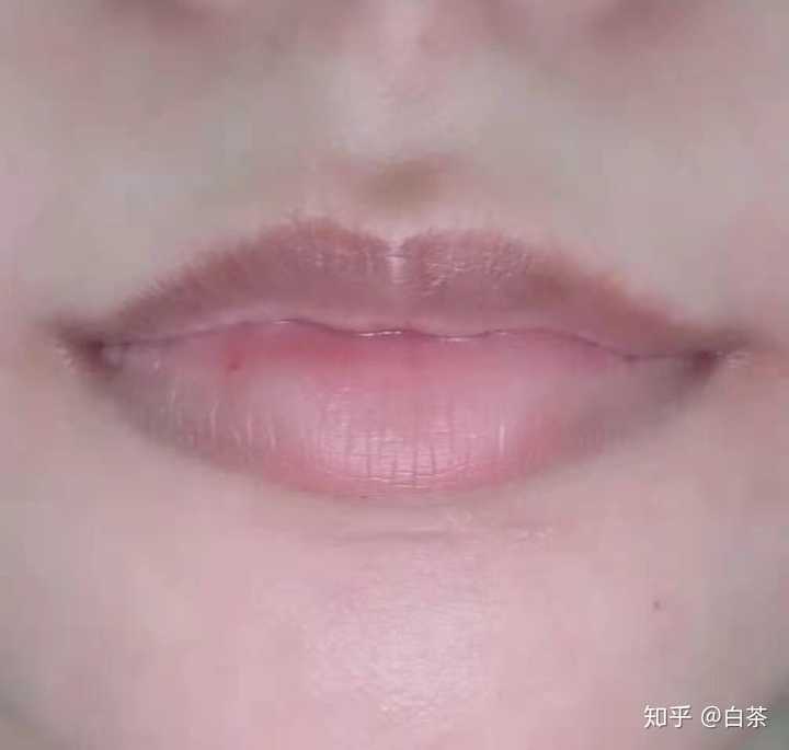 如何去除嘴角的黑色素 知乎 如何去除嘴角的黑色素 知乎