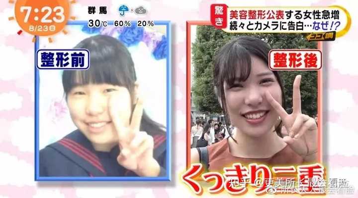 如何去日本整容 知乎
