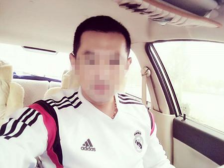 植发后多久可以长出新头发? - 脂溢性脱发