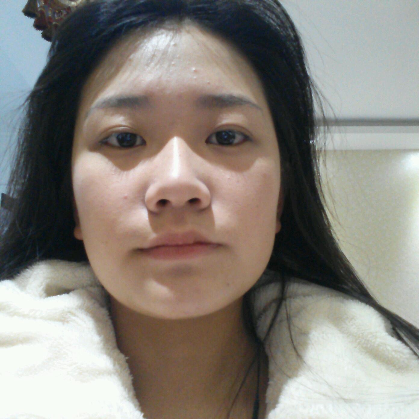 下颌骨有点宽的女生怎么办