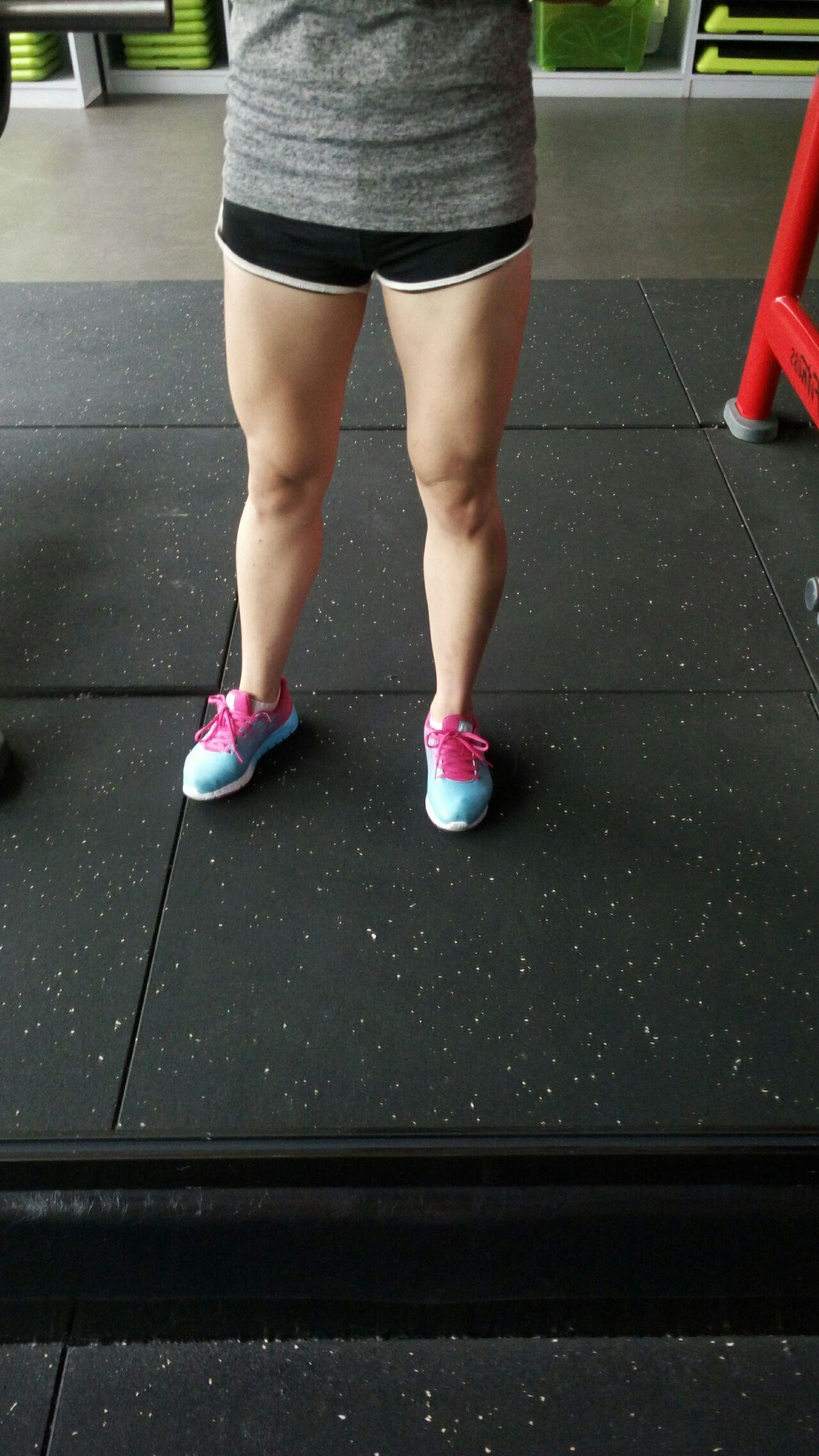 膝盖斜上方靠近大腿内侧肌肉突出怎么办