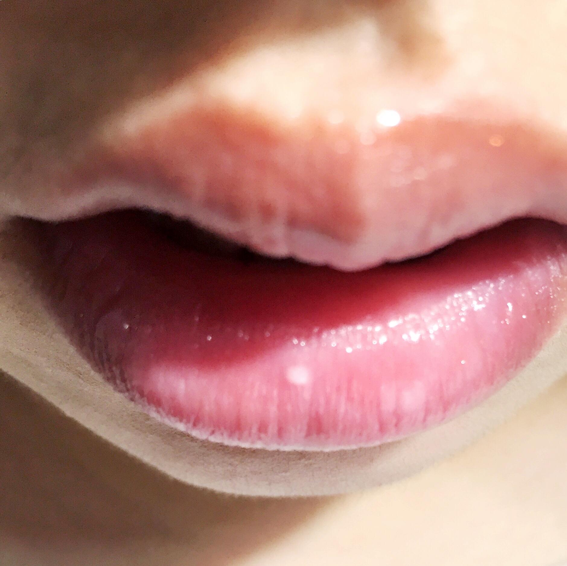 上嘴唇有很多小白点,感觉是在皮下,不痛不痒,但是唇色会不好看,那是