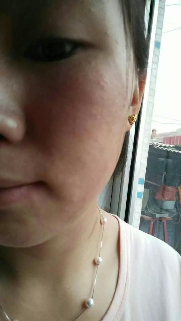 商品，我打开用了一次，结果面部过敏，很严重的，满脸疙瘩，又红又痒。我拿到商场专柜去验货，导购告诉我是假货，我头都发昏了。拨打该网站订