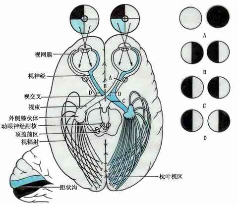 更換神經元后,終於雙側動眼神經副核.