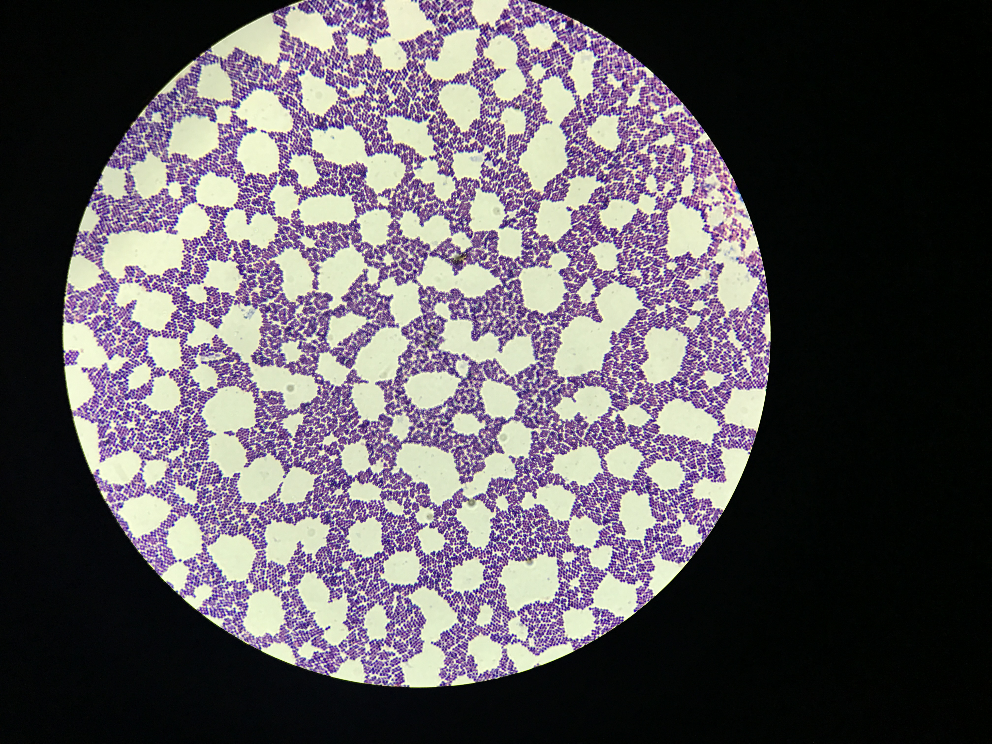细菌简单染色图片