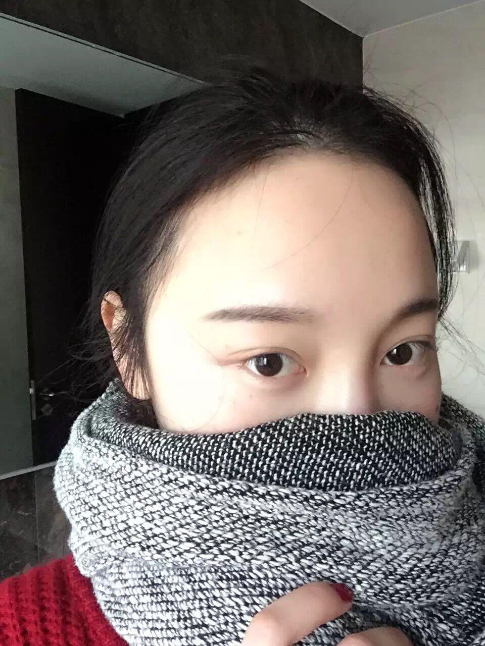 20岁的女生如何改善皮肤暗黄和黑眼圈? - 生活