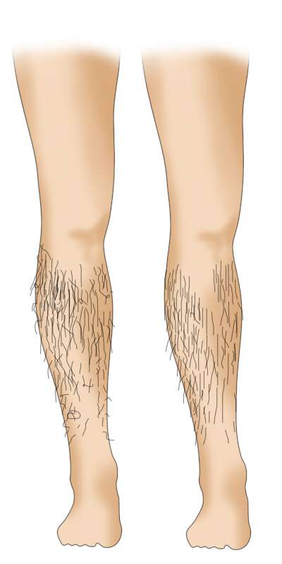 男生怎么打理腿毛