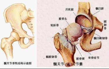 股骨骨小梁位置图图片