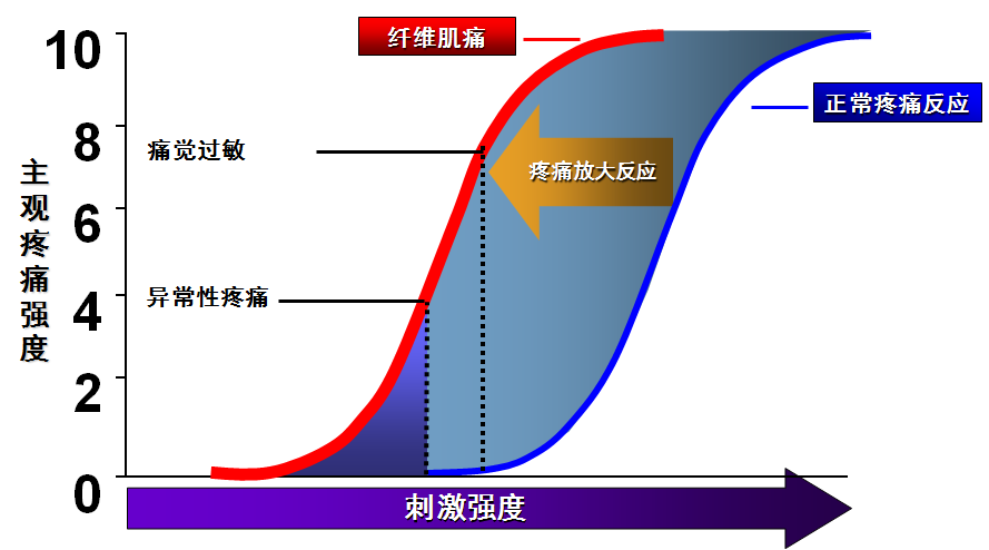 科普时间 一种奇怪的痛 知乎