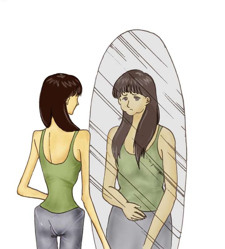 一个骨瘦如柴女孩得了躯体化障碍,总是觉得自己胖.